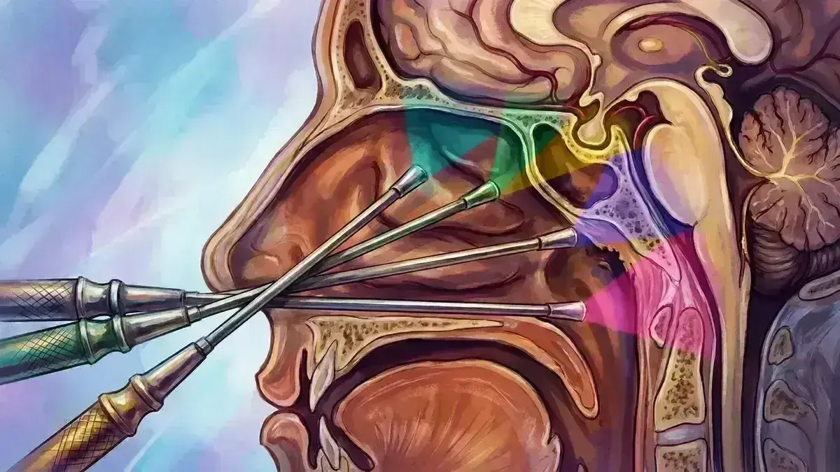 Abordagem Endoscópica Endonasal Ampliada