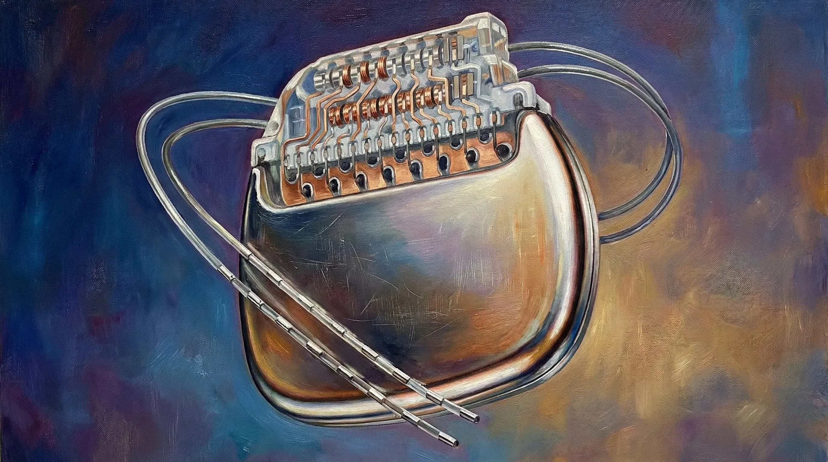 ✨ Implante de Estimulador da Medula Espinhal (Spinal Cord Stimulation)