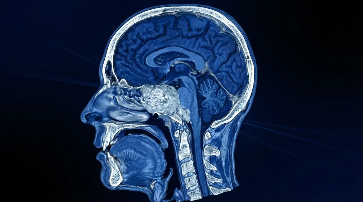 🧠 Ressecção de Craniofaringioma