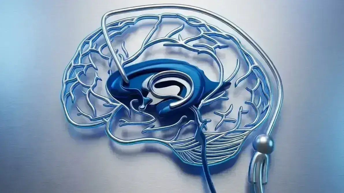 Revisão de Sistema de Derivação (Shunt)