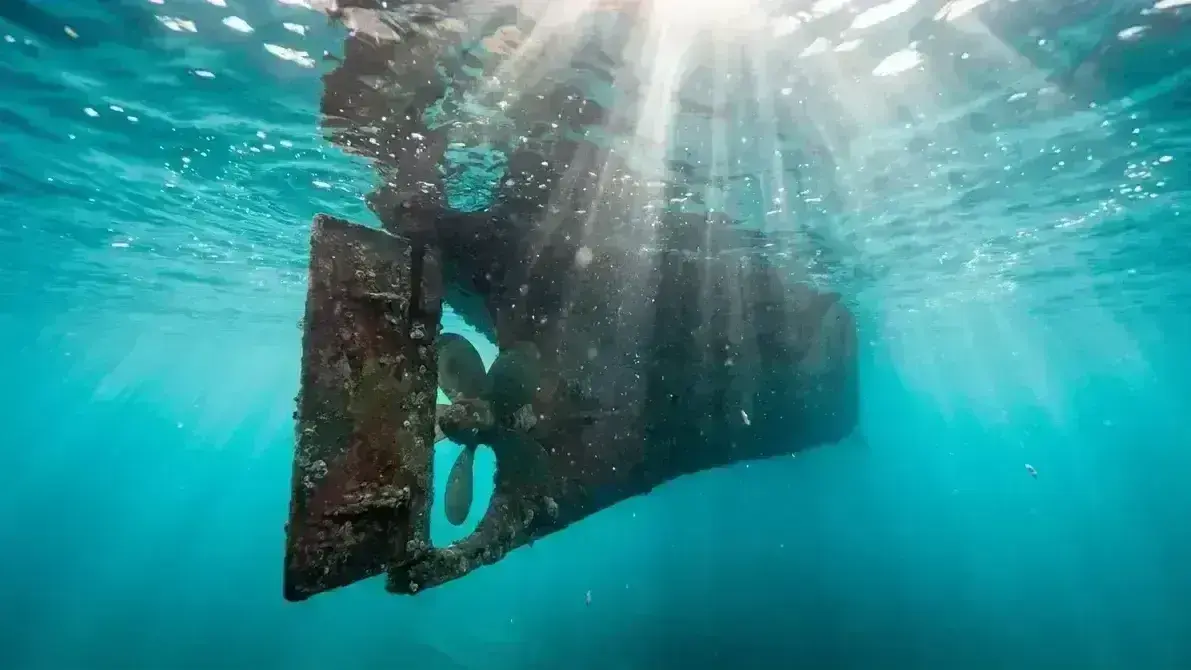 Diastematomielia (Medula Bífida)