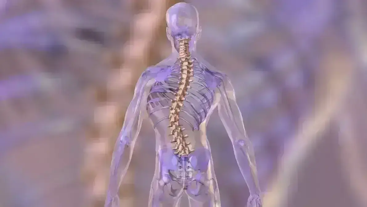 Escoliose Degenerativa do Adulto