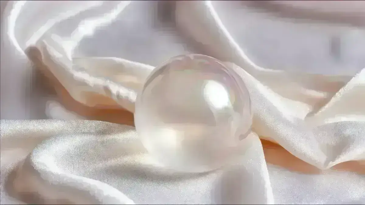 Cisto Aracnoide da Fossa Média