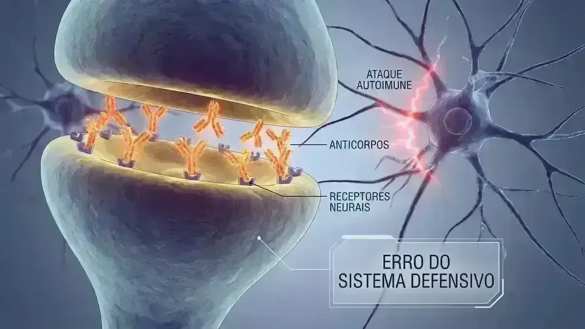 Encefalite Autoimune Anti-NMDA