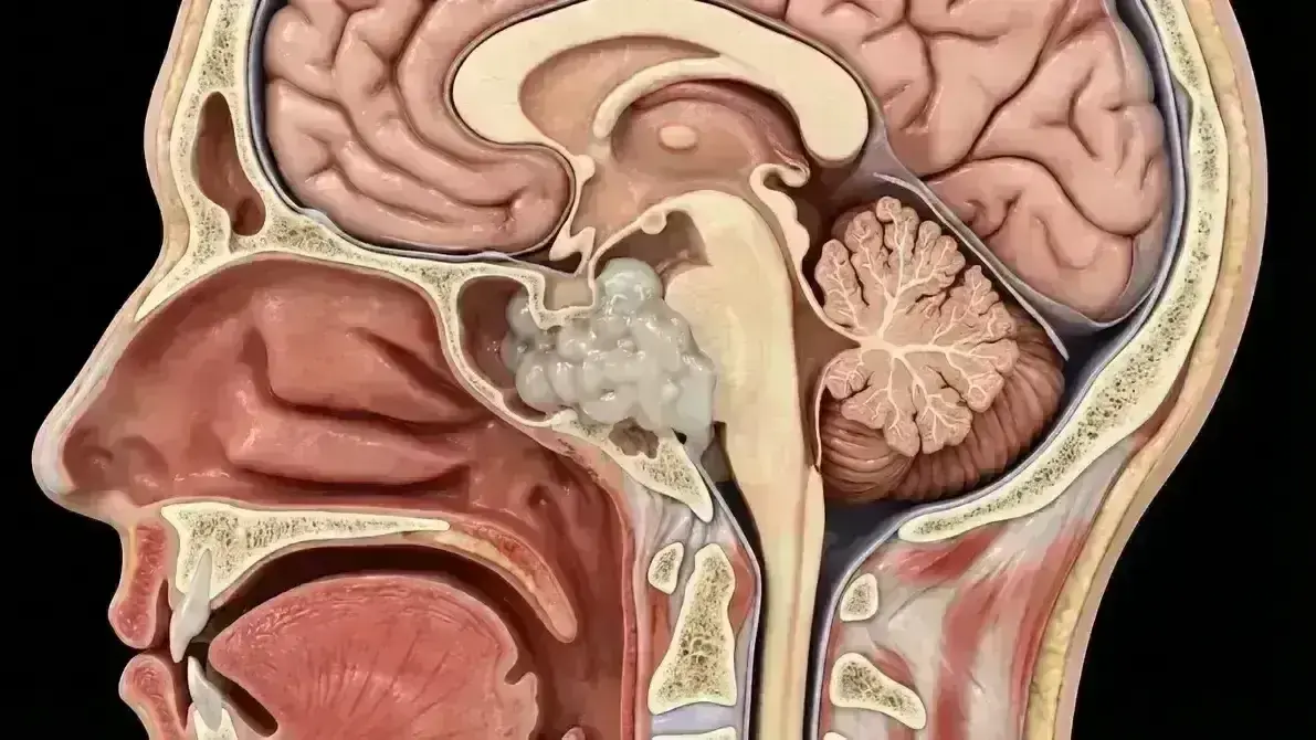 🐚 Cordoma de Clivus